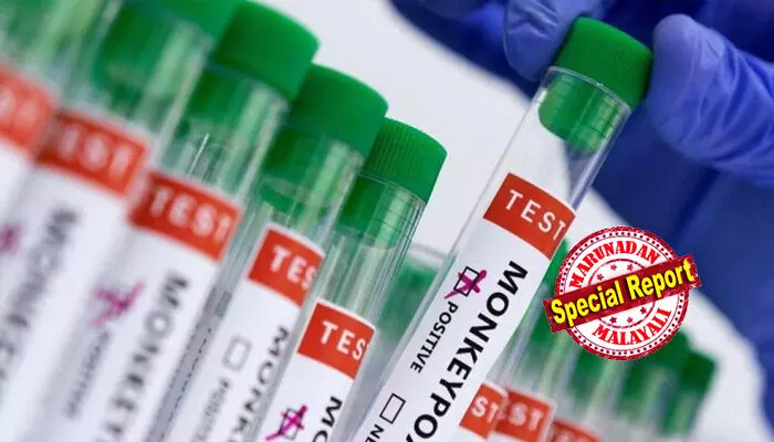 ഇന്ത്യയില് ആര്ക്കും എം പോക്സ് സ്ഥിരീകരിച്ചിട്ടില്ല; ജാഗ്രതാ നടപടികളെടുക്കാന് സംസ്ഥാനങ്ങളോട് ആരോഗ്യമന്ത്രാലയം; പരിശോധനയും നിരീക്ഷണവും ശക്തമാക്കണം ഇന്ത്യയില് ആര്ക്കും എം പോക്സ് സ്ഥിരീകരിച്ചിട്ടില്ല; ജാഗ്രതാ നടപടികളെടുക്കാന് സംസ്ഥാനങ്ങളോട് ആരോഗ്യമന്ത്രാലയം; പരിശോധനയും നിരീക്ഷണവും ശക്തമാക്കണം