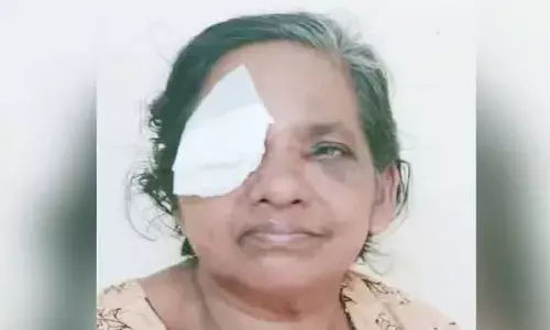 കുരങ്ങ് തേങ്ങ പറിച്ച് എറിഞ്ഞു; വീട്ടമ്മയുടെ കണ്ണിന് പരിക്ക്: കുരങ്ങ് ശല്യത്തില്‍ പൊറുതിമുട്ടി നാട്ടുകാര്‍