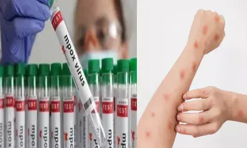 സംസ്ഥാനത്ത് മലപ്പുറത്ത് എംപോക്സ് സ്ഥിരീകരിച്ചു; രോഗം സ്ഥിരീകരിച്ചത് യുഎഇയില്‍ നിന്നും വന്ന 38 കാരന്; ജാഗ്രത പാലിക്കണമെന്ന് ആരോഗ്യ വകുപ്പിന്റെ മുന്നറിയിപ്പ്; എന്താണ് എംപോക്സ്?