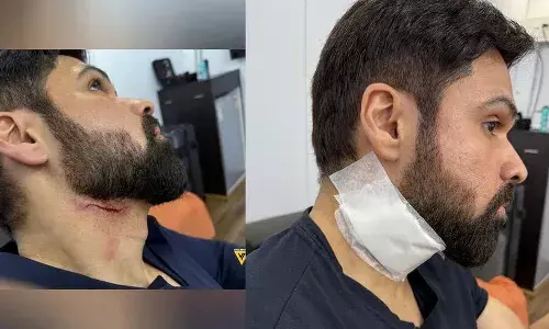 ആക്ഷന്‍ രംഗങ്ങള്‍ ഷൂട്ട് ചെയ്യുന്നതിനിടെ ബോളിവുഡ് താരം ഇമ്രാന്‍ ഹാഷ്മിക്ക് പരിക്ക്; കഴുത്തിന് മുകളിലായിയാണ് പരിക്ക്