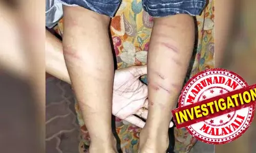 കുട്ടി കരയാതിരുന്നതോടെ വീണ്ടും വീണ്ടും അടിച്ച് രസിച്ച് അധ്യാപിക; യു.കെ.ജി. വിദ്യാര്‍ഥിയെ അതിക്രൂരമായി തല്ലിച്ചതച്ച സംഭവം: ഒളിവില്‍ പോയ അധ്യാപികയ്ക്കായി തിരച്ചില്‍