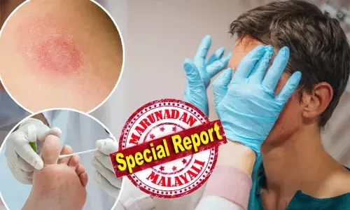 ജനനേന്ദ്രിയത്തെ ഗുരുതരമായി ബാധിക്കുന്ന ഫംഗസ് രോഗം യൂറോപ്യന്‍ രാജ്യങ്ങളില്‍ പടരുന്നു; ലക്ഷണം ജനനേന്ദ്രിയത്തിലും തുടയിലും നിതംബത്തിലും വേദനയും തടിപ്പും; രോഗം പടരാനും സാധ്യത കൂടുതല്‍