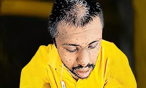 കടന്നല്‍ ആക്രമണം; സംസാരശേഷിയില്ലാത്ത യുവാവിന് ഗുരുത പരിക്ക്