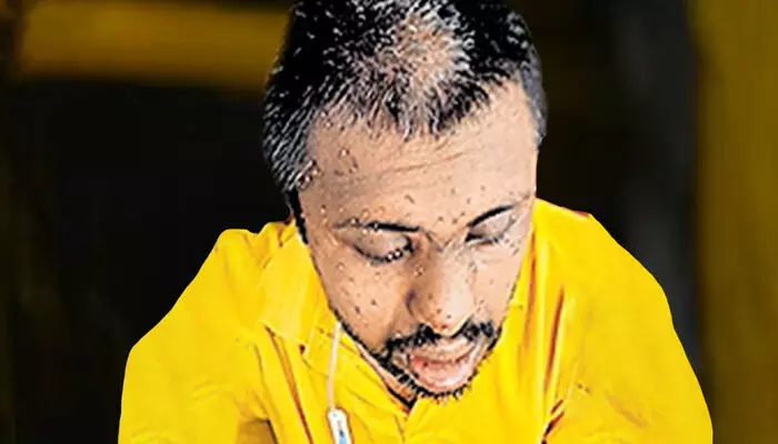 കടന്നല്‍ ആക്രമണം; സംസാരശേഷിയില്ലാത്ത യുവാവിന് ഗുരുത പരിക്ക്