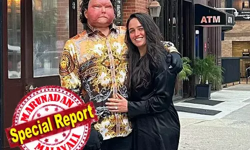 തീപിടിച്ച കാറില്‍ നിന്ന് രക്ഷപ്പെടുമ്പോള്‍ കൈകാലുകളും മുഖവും ബാക്കിയുണ്ടായിരുന്നില്ല; ലോകത്തെ ആദ്യ സമ്പൂര്‍ണ മുഖമാറ്റ ശസ്ത്രക്രിയയിലൂടെ ജീവിതം തിരിച്ചുപിടിച്ചയാള്‍ക്ക് ഒടുവില്‍ പ്രണയജീവിതവും