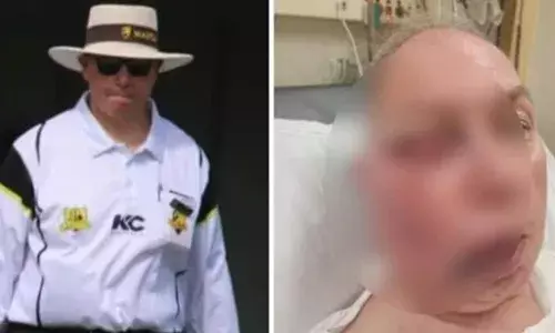 ബാറ്ററുടെ സ്ട്രൈറ്റ് ഡ്രൈവ് നേരിട്ട് ചെന്നെത്തിയത് അംപയറുടെ മുഖത്ത്; ക്രിക്കറ്റ് മത്സരത്തിനിടെ അംപയര്‍ക്ക് പരിക്ക്; പരിക്ക് ഗുരുതരമല്ലെന്ന് സബര്‍ബന്‍ ടര്‍ഫ് ക്രിക്കറ്റ് അസോസിയേഷന്‍