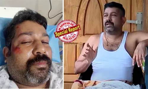 എന്തിനാടോ ഇവിടെ വണ്ടി നിർത്തിയെ..;നീയൊക്കെ ആരാടാ; ബൈക്ക് യാത്രികനെ സിപിഎം പ്രവർത്തകർ ക്രൂരമായി തല്ലിച്ചതച്ചതായി ആരോപണം; പരാതി നൽകിയിട്ടും നോ രക്ഷ; കണ്ണടച്ച് പോലീസ്; നീതിക്കായി കോടതി കയറാനൊരുങ്ങി ഒരു കുടുംബം..!