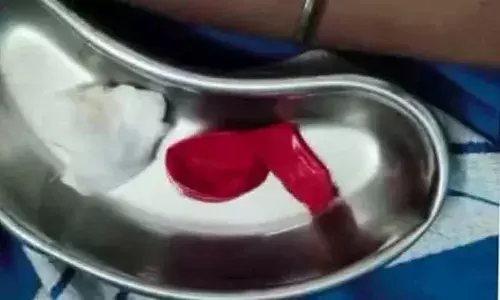 ബലൂൺ വീർപ്പിക്കുന്നതിനിടെ തൊണ്ടയിൽ കുടുങ്ങി; 13 വയസ്സുകാരന് ദാരുണാന്ത്യം; സംഭവം കർണാടകയിൽ