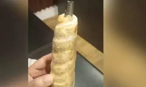 ക്രീം റോളിൽ ഇരുമ്പ് കഷ്ണം; റോൾ കഴിക്കുന്നതിനിടെ ഇരുമ്പ് വായിൽ കയറി; ഏഴു വയസുകാരിയ്‌ക്ക് ഗുരുതര പരിക്ക്; ബേക്കറി ഉടമയ്‌ക്കെതിരെ പരാതി