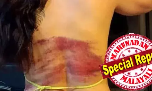 ഹിജാബ് നിയമത്തില്‍ പിടി മുറുക്കി ഇറാന്‍; വിസമ്മതിച്ച യുവതിയുടെ പുറം അടിച്ചുപൊട്ടിച്ചു; മുറിവേറ്റ പിറകുവശത്തിന്റെ ചിത്രം സോഷ്യല്‍ മീഡിയയില്‍ വൈറല്‍