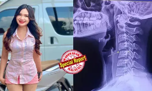 നെക്ക് ട്വിസ്റ്റിങ് മസാജ് ചെയ്ത തായ്ലന്‍ഡ് ഗായികക്ക് കഴുത്തിന് ഗുരുതര ക്ഷതം; ആശുപത്രിയിലായ ഇവര്‍ അണുബാധയെ തുടര്‍ന്ന് മരിച്ചു; അറിവില്ലാത്തവര്‍ക്ക് ചെയ്യാനുള്ളതല്ല ഇത്; നമ്മുടെ ബാര്‍ബര്‍ ഷാപ്പുകളില്‍ അടക്കം കഴുത്തുവെട്ടിക്കല്‍ മസാജിന് വിധേയരാവുന്നവര്‍  സൂക്ഷിക്കുക!