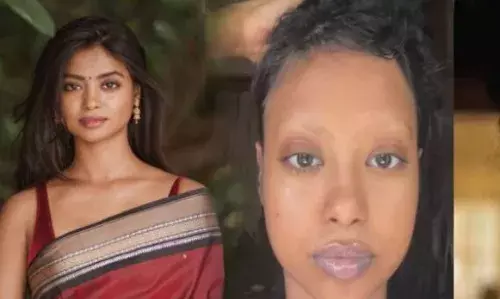 മുടി കാെഴിയുന്നു; സ്റ്റിറോയ്ഡ് ഇൻജെക്ഷൻ എടുക്കേണ്ട സ്ഥിതിയായിരുന്നു; തനിക്ക് ബാധിച്ച അപൂർവ രോ​ഗം വെളിപ്പെടുത്തി കമ്മട്ടിപ്പാടം നായിക ഷോൺ റോമി