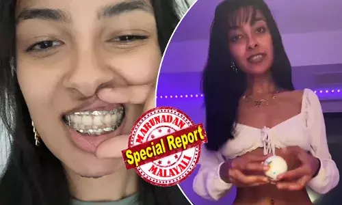 കാൻഡി കഴിക്കാനിഷ്ടം; ഷോപ്പിംഗിനിടെ ഒരു ഫേമസ് മിഠായി കണ്ടു; ധൃതിപ്പെട്ട് വാങ്ങി കടിച്ചു പൊട്ടിച്ചത് വിനയായി; താടിയെല്ല് പൊട്ടി; പല്ലുകൾ ഇളകി; വേദന സഹിക്കാൻ കഴിയാതെ പെൺകുട്ടി; എക്സ് റേ,സിടി സ്കാനിലും ഞെട്ടിപ്പിക്കുന്ന വിവരങ്ങൾ; മിഠായി കടിച്ച 19-കാരിക്ക് സംഭവിച്ചത്!