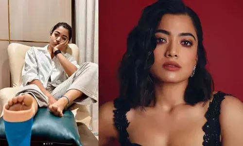 കാലില്‍ പ്ലാസ്റ്ററുമായി രശ്മിക മന്ദാന; ജിം വര്‍ക്കൗട്ടിനിടെ പരിക്കേറ്റു; ആഴ്ചകളോ മാസങ്ങളോ ഇനി ഒറ്റക്കാലിലെന്ന് താരം