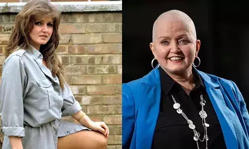 പോപ്പ് സ്റ്റാറും കോളമിസ്റ്റുമായ ലിന്‍ഡ നോളന്‍ അന്തരിച്ചു; ടെലിവിഷന്‍ അവതാരിക, കോളമിസ്റ്റ് എന്നീ നിലകളിലെല്ലാം തിളങ്ങിയ വ്യക്തി