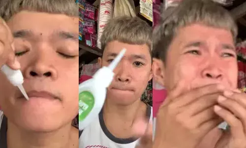 വൈറലാകാന്‍ ഇരുചുണ്ടുകളിലും സൂപ്പര്‍ ഗ്ലൂ പുരട്ടി യുവാവ്; ചാലഞ്ച് വിജയിച്ചെങ്കിലും പിന്നെ വാ തുറക്കാനേ പറ്റിയില്ല; ഫിലിപ്പീന്‍സ് സ്വദേശിക്ക് എട്ടിന്റെ പണി കിട്ടിയ സൂപ്പര്‍ ഗ്ലൂ ചാലഞ്ച്