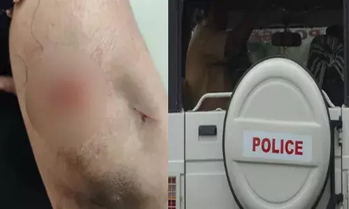 വീട്ടിലേക്ക് പോകുമ്പോള്‍ ഓവര്‍ടേക്ക് ചെയ്‌തെത്തി ആക്രമണം; മലപ്പുറത്ത് സ്കൂട്ടറിൽ സഞ്ചരിക്കുകയായിരുന്ന അമ്മയെയും മകളെയും വെട്ടി; കാരണം വ്യക്തമല്ല; അന്വേഷണം തുടങ്ങി