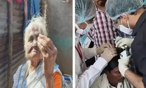 മഹാരാഷ്ട്രയിലെ ബുല്‍ധാന ജില്ലയിലെ അസാധാരണ മുടികൊഴിച്ചില്‍; വില്ലൻ റേഷന്‍ കടകളിലൂടെ വിതരണം ചെയ്ത ഗോതമ്പ്