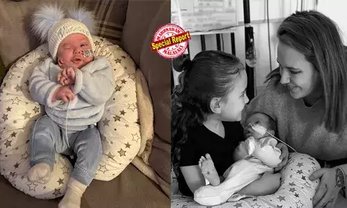 വലത് കവിളില്‍ ഒരുകുഞ്ഞുചെവിയുമായി കുഞ്ഞ്; ജന്മനാ വലതുകണ്ണുമില്ല; ആദ്യമൊന്ന് ഞെട്ടിയെങ്കിലും മാതാപിതാക്കളായ ഗ്രേസിനും റൈസിനും മനസ്സിലായി ഇതൊരു അപൂര്‍വരോഗാവസ്ഥ; ഗോള്‍ഡന്‍ഹാര്‍ സിന്‍ഡ്രോം ബാധിക്കാറുള്ളത് 25,000 പേരില്‍ ഒരാളെ