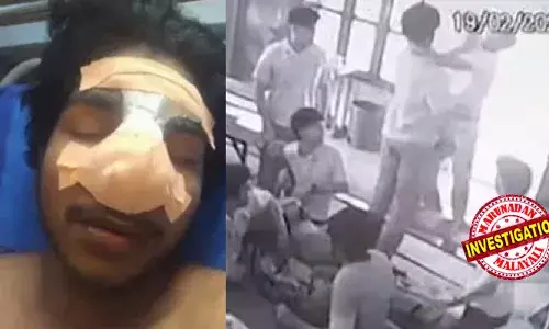 ഒറ്റപ്പാലത്തെ സ്വകാര്യ ഐടിഐയില്‍ വിദ്യാര്‍ഥികളുടെ തമ്മില്‍ത്തല്ല്; സഹപാഠിയുടെ മര്‍ദ്ദനമേറ്റ് വിദ്യാര്‍ത്ഥിയുടെ മൂക്കിന്റെ എല്ല് പൊട്ടി;  ഇടതുകണ്ണിന് താഴെ ആഴത്തില്‍ മുറിവ്;  20കാരനെ അറസ്റ്റ് ചെയ്തു ജാമ്യത്തില്‍ വിട്ടു; ആക്രമണത്തിന്റെ ദൃശ്യം പുറത്ത്