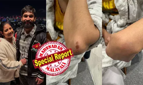 യുകെയില്‍ മലയാളി നഴ്‌സിന് നേരെ വംശീയാക്രമണം; ഭര്‍ത്താവിനൊപ്പം നടക്കവേ എതിരെ വന്ന ബ്രിട്ടീഷ് യുവതിയുടെ ആക്രമണത്തില്‍ മലയാളി യുവതിക്ക് പരിക്കും; കടയില്‍ ജോലിക്കെത്തിയ മലയാളി വിദ്യാര്‍ത്ഥിക്കു നേരെയും ആക്രമണം; വലതു പക്ഷ പാര്‍ട്ടി ശക്തി കാട്ടുമ്പോള്‍ വംശീയത തല പൊക്കുമെന്ന ആശങ്കയോടെ മലയാളികള്‍