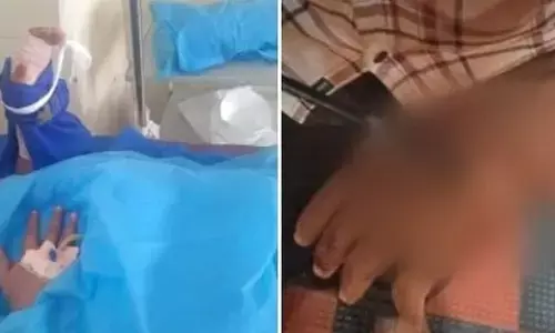 കണ്ണൂരിൽ മുള്ളൻപന്നി ആക്രമണം: പ്ലസ് വൺ വിദ്യാർത്ഥിക്ക് പരിക്ക്; തുളച്ചുകയറിയത് 12 മുള്ളുകൾ