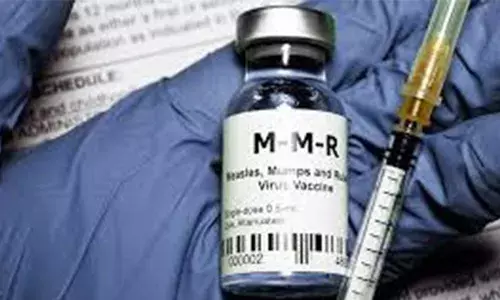 കേരളത്തില്‍ വീണ്ടും മുണ്ടിനീരിന്റെ സാന്നിധ്യം; 14 മാസത്തിനിടെ സംസ്ഥാനത്ത് 74,300 കുട്ടികള്‍ക്ക് മുണ്ടിനീര് സ്ഥിരീകരിച്ചു; എംഎംആര്‍ വാക്‌സിന്‍ ഇല്ലാത്തത് രോഗം കൂടാന്‍ കാരണം