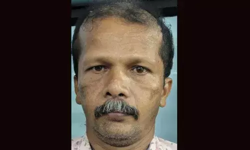 ഒരുമിച്ച് മദ്യപാനം ഒടുവില്‍ ഷെയറിനെ ചൊല്ലി സുഹൃത്തുക്കളുടെ തര്‍ക്കം; മര്‍ദനമേറ്റ് രണ്ടു തവണ റോഡില്‍ തലയടിച്ചു വീണയാളുടെ നില അതീവഗുരുതരം; പ്രതി അറസ്റ്റില്‍