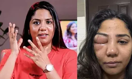 കണ്ണാടിയില്‍ നോക്കാന്‍ പോലും പേടിച്ച ദിവസങ്ങള്‍; ആഗ്രഹിച്ചത് പലതും ഒഴിവാക്കേണ്ടി വന്നു; സിനിമ പ്രമോഷനിടെ വീണ മാത്രമെന്താണ് കൂളിംഗ് ഗ്ലാസ് വെച്ചിരിക്കുന്നത് എന്ന ചോദ്യങ്ങള്‍ വരെ ഉയര്‍ന്നു; എന്റെ ആത്മവിശ്വാസം സീറോയിലും താഴെ പോയ ദിനങ്ങള്‍; രോഗാവസ്ഥയെ കുറിച്ച് തുറന്ന് പറഞ്ഞ് വീണ മുകുന്ദന്‍