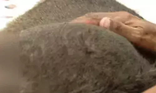 വിളിച്ചപ്പോള്‍ അടുത്തേയ്ക്ക് വന്നില്ല; വളര്‍ത്തുനായയെ ഉടമസ്ഥന്‍ വെട്ടി പരിക്കേല്‍പ്പിച്ച് റോഡില്‍ ഉപേക്ഷിച്ചു; ഉടമ മദ്യലഹരിയിലായിരുന്നുവെന്ന് ദൃക്‌സാക്ഷികള്‍; പോലീസ് കേസ് രജിസ്റ്റര്‍ ചെയ്തു