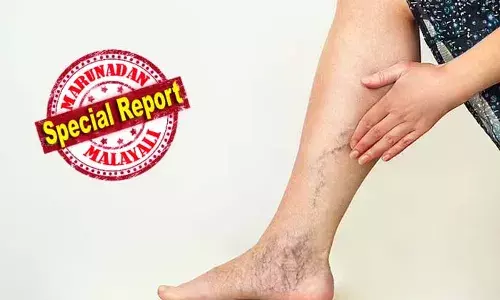 വെരിക്കോസ് വെയിന്‍ കാരണം ബുദ്ധിമുട്ട് അനുഭവിക്കുന്നവര്‍ക്ക് ഡിമെന്‍ഷ്യ രോഗം വരാന്‍ സാധ്യത കൂടുതല്‍; ശരീരത്തില്‍ ഉണ്ടാകുന്ന മുഴുകളും പ്രശ്‌നം സൃഷ്ടിക്കും; കൊറിയയില്‍ പഠനത്തിന്റെ റിപ്പോര്‍ട്ട് പുറത്ത്