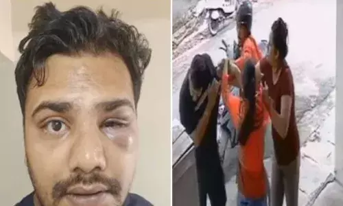 ഓർഡർ ചെയ്ത സാധനവുമായി എത്തി; ഡെലിവറി ബോയ് ഉപഭോക്താവിനെ മർദിച്ചു; വീട് അഡ്രസ് തെറ്റിയെന്ന് ആരോപണം; തലയോട്ടിക്ക് മാരക പരിക്ക്; നടപടി എടുക്കുമെന്ന് കമ്പനി