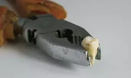 തുര്‍ക്കിയിലെ ദന്ത ചികിത്സ അത്യന്തം അപകടകരമെന്ന് റിപ്പോര്‍ട്ട്; ദുരിതം മാറാതെ അനുഭവസ്ഥര്‍