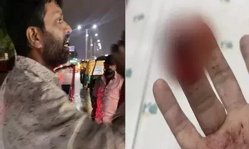 എന്താണ്...ബ്രോ; മഴവെള്ളം തെറിപ്പിച്ചെന്ന് പരാതി; വാക്കുതർക്കത്തിന് പിന്നാലെ കൈവിട്ട കളി; യുവാവിന്റെ മോതിര വിരൽ കടിച്ചുപറിച്ചു; കേസെടുത്ത് പോലീസ്