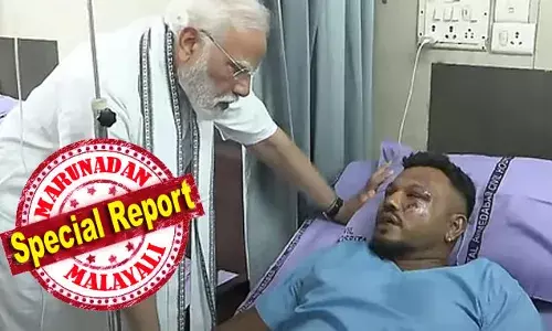 താന്‍ എങ്ങനെയാണ് രക്ഷപ്പെട്ടത് എന്ന കാര്യം വിശ്വാസ് കുമാറിന് തന്നെ കൃത്യമായി ഇപ്പോഴും ഓര്‍ക്കാന്‍ കഴിയുന്നില്ല; ഇത് വലിയൊരു അത്ഭുതം തന്നെയെന്ന് ചര്‍ച്ച ചെയ്ത് ആഗോള മാധ്യമങ്ങള്‍; അഹമ്മദാബാദില്‍ രക്ഷപ്പെട്ട ഏക യാത്രക്കാരന്‍ രണ്ടു ദിവസത്തിനകം ആശുപത്രി വിടും