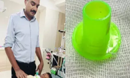 ഒരു വര്‍ഷമായി നിരന്തരം തൊണ്ടവേദന; ആറു വയസ്സുകാരന്റെ തൊണ്ടയില്‍ നിന്നും പുറത്തെടുത്തത് കളിപ്പാട്ടത്തിനുള്ളിലെ പ്ലാസ്റ്റിക്
