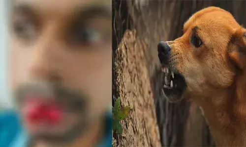 ഒരാളുടെ ചുണ്ട് കടിച്ചുപറിച്ച നിലയിൽ..; കോട്ടയത്ത് തെരുവ് നായ ആക്രമണം; നാലുപേർക്ക് ഗുരുതര പരിക്ക്; ആശുപത്രിയിൽ പ്രവേശിപ്പിച്ചു