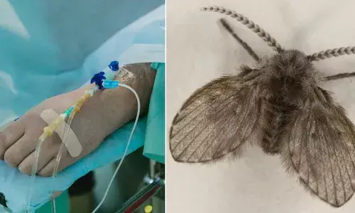 എട്ട് വയസ്സുകാരി ജീവനുള്ള വിരകളെ ഛർദിക്കുന്നത് കണ്ട് വീട്ടുകാർക്ക് ടെൻഷൻ; ഒരു മാസം കഴിഞ്ഞിട്ടും മാറ്റമില്ല; ആശുപത്രി സ്കാനിങ്ങിൽ ഡോക്ടർമാർക്ക് അമ്പരപ്പ്; വില്ലനായത് ചെറിയൊരു പ്രാണി!