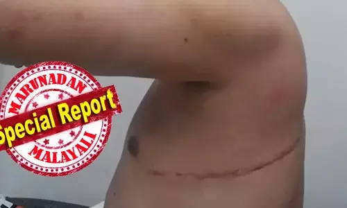 വ്യാവസായിക അടിസ്ഥാനത്തില്‍ അവയവ ശേഖരണം വര്‍ദ്ധിപ്പിക്കും; അതും ചൈനയ്ക്ക് കച്ചവടം; ഉയ്ഗൂര്‍ മുസ്ലീങ്ങള്‍ താമസിക്കുന്ന പ്രവിശ്യയില്‍ അവയവമാറ്റ സൗകര്യങ്ങളുടെ എണ്ണം മൂന്നിരട്ടിയാക്കുമ്പോള്‍