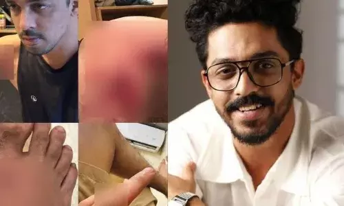 ആക്ഷൻ രംഗം ചിത്രീകരിക്കുന്നതിടെ നടൻ സാ​ഗർ സൂര്യയ്ക്ക് പരിക്ക്; അപകടം പ്രകമ്പനം സിനിമയുടെ  ആദ്യ ഷെഡ്യൂൾ പൂർത്തിയാക്കാനിരിക്കെ