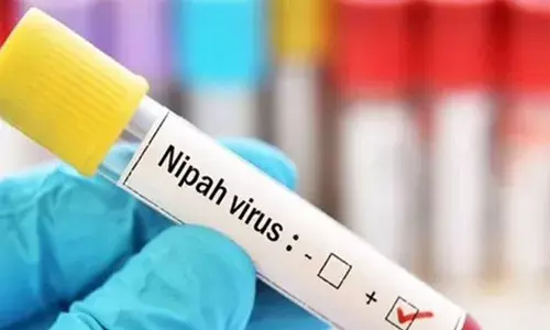 സംസ്ഥാനത്ത് വീണ്ടും നിപ മരണം; മരിച്ചത് മണ്ണാര്‍ക്കാട് സ്വദേശിയായ അമ്പതുകാരന്‍; ജാഗ്രതാ നിര്‍ദ്ദേശം നല്‍കി ആരോഗ്യ വകുപ്പ്