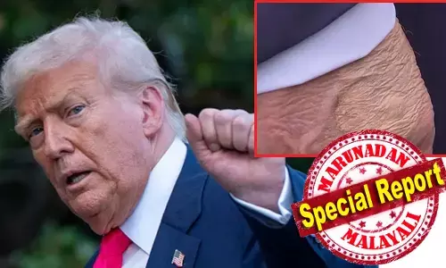 ട്രംപിന്റെ പ്രായം അദ്ദേഹത്തിന്റെ ചര്‍മ്മത്തെ കൂടുതല്‍ ദുര്‍ബലമാക്കിയിരിക്കാം; കൈയ്യുടെ പിന്‍ഭാഗത്തുള്ള ഒരു പാട് മറയ്ക്കുന്ന മേക്കപ്പ് ചര്‍ച്ചകളില്‍; വൃത്താകൃതിയില്‍ ചര്‍മ്മഭാഗം മറച്ചുവെച്ച ട്രംപ്; അമേരിക്കന്‍ പ്രസിഡന്റിന് സംഭവിച്ചത് എന്ത്?