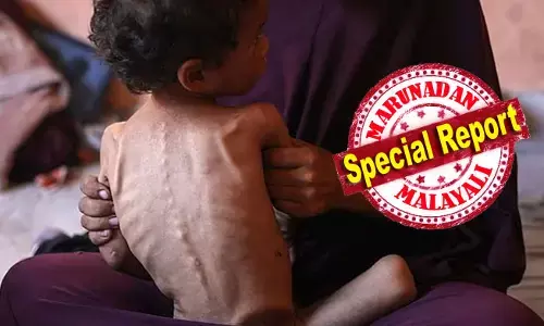 24 മണിക്കൂറിനുള്ളില്‍ പോഷകാഹാര കുറവ് കാരണം പത്ത് പേര്‍ മരിച്ചുവെന്ന് യുഎന്‍; ഹമാസിന്റെ കണക്കില്‍ മരണം 111; ഗാസയിലെ ജനങ്ങളെ ഇസ്രയേല്‍ പട്ടിണിക്കിടുകയാണെന്ന ആരോപണവുമായി സന്നദ്ധ സംഘടനകള്‍