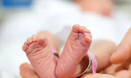 മധ്യപ്രദേശില്‍ രണ്ടു തലയുമായി നവജാത ശിശു; കുഞ്ഞ് നിലവില്‍ ഗുരുതരാവസ്ഥയില്‍