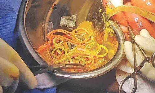 വയറു വേദനയുമായി ആശുപത്രിയിലെത്തി; ശസ്ത്രക്രിയയിലൂടെ യുവതിയുടെ വയറ്റില്‍ നിന്നും പുറത്തെടുത്തത് 41 റബ്ബര്‍ ബാന്‍ഡുകള്‍