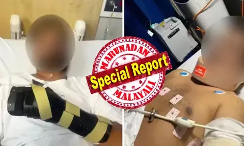 ഓസ്‌ട്രേലിയയില്‍ ഇന്ത്യന്‍ വംശജന് നേരെ വംശീയ ആക്രമണം; വടിവാള് കൊണ്ടുള്ള ആക്രമണത്തില്‍ വെട്ടേറ്റ് കൈ മുറിഞ്ഞ് തൂങ്ങി; 33കാരന്റെ ചുമലിലും പുറത്തും വെട്ടേറ്റ പാടുകള്‍: നട്ടെല്ലിനും തലയ്ക്കും പരിക്ക്