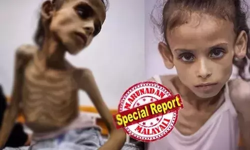 ഗാസയിലെ ജീവനുള്ള അസ്ഥികൂടം..! ഭക്ഷണമില്ലാതെ പട്ടിണി കിടന്ന് എല്ലും തോലും മാത്രമായി മാറിയ പെണ്‍കുട്ടിയുടെ നടുക്കുന്ന ചിത്രങ്ങള്‍ പുറത്ത്; ഇസ്രായേലി ബന്ദി അസ്ഥിപഞ്ചരമായി സ്വന്തം കുഴി തോണ്ടുന്ന ദൃശ്യങ്ങളില്‍ ഇസ്രായേല്‍ നടപടി ആവശ്യപ്പെടുമ്പോള്‍ മറുവശത്ത് കൊടുംപട്ടിണിയുടെയും പോഷകാഹാര കുറവിന്റെയും നേര്‍ചിത്രം ഇങ്ങനെ; ഗാസയിലെ പട്ടിണി ഹൃദയഭേദകമാകുമ്പോള്‍..