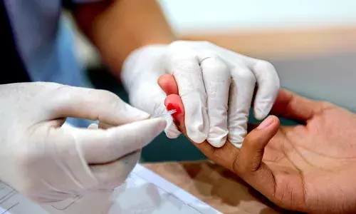 സംസ്ഥാനത്ത് യുവാക്കള്‍ക്കിടയില്‍ എച്ചഐവി ബാധ കൂടുന്നു; 2024-25-ല്‍ രോഗം സ്ഥിരീകരിക്കപ്പെട്ടവരില്‍ 14 ശതമാനം പേര്‍ 19-നും 25-നും ഇടയില്‍ പ്രായമുള്ളവര്‍