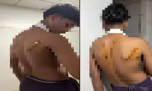 മലപ്പുറത്ത് പതിനേഴുകാരനെ സംഘം ചേർന്ന് മർദ്ദിച്ചു; ആക്രമണത്തിൽ വിദ്യാർത്ഥിയുടെ കൈ ഒടിഞ്ഞു, ശരീരത്തില്‍ മുറിവേറ്റു; കേസെടുത്ത് പോലീസ്