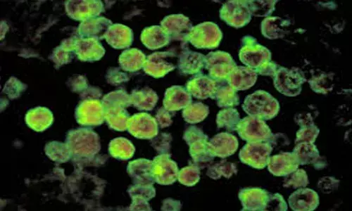 മലപ്പുറത്ത് ഒരാള്‍ക്ക് കൂടി അമീബിക് മസ്തിഷ്‌ക ജ്വരം; രോഗം സ്ഥിരീകരിച്ചത 55 വയസുകാരിക്ക്